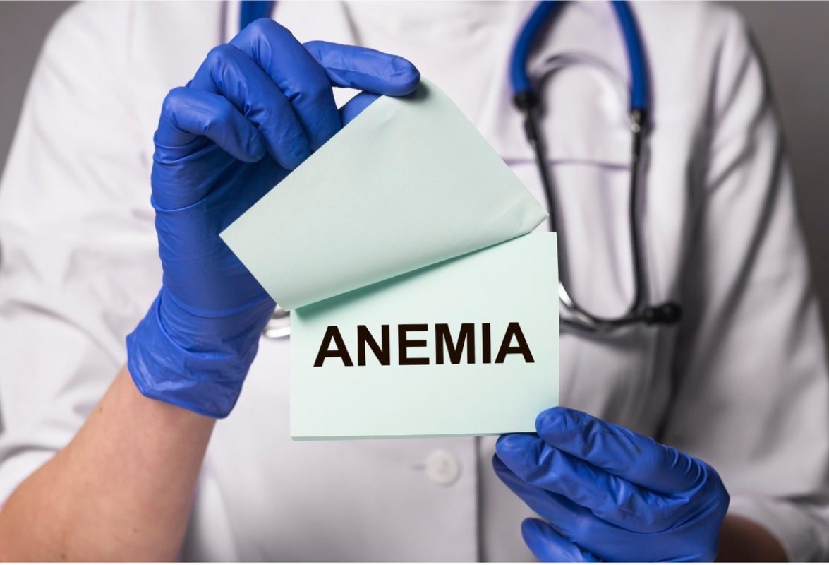 anemia por déficit de hierro